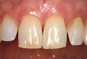 Smile gallery case 7 — before treatment